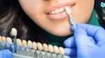 بستن فاصله بین دندان ها با کامپوزیت، ونیر، بریج و ارتودنسی