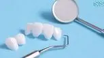 لمینت دندان چیست؟ چگونه انجام می شود؟