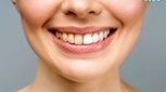 زرد شدن دندان‌: علت‌ها، درمان‌ها و جلوگیری از آن