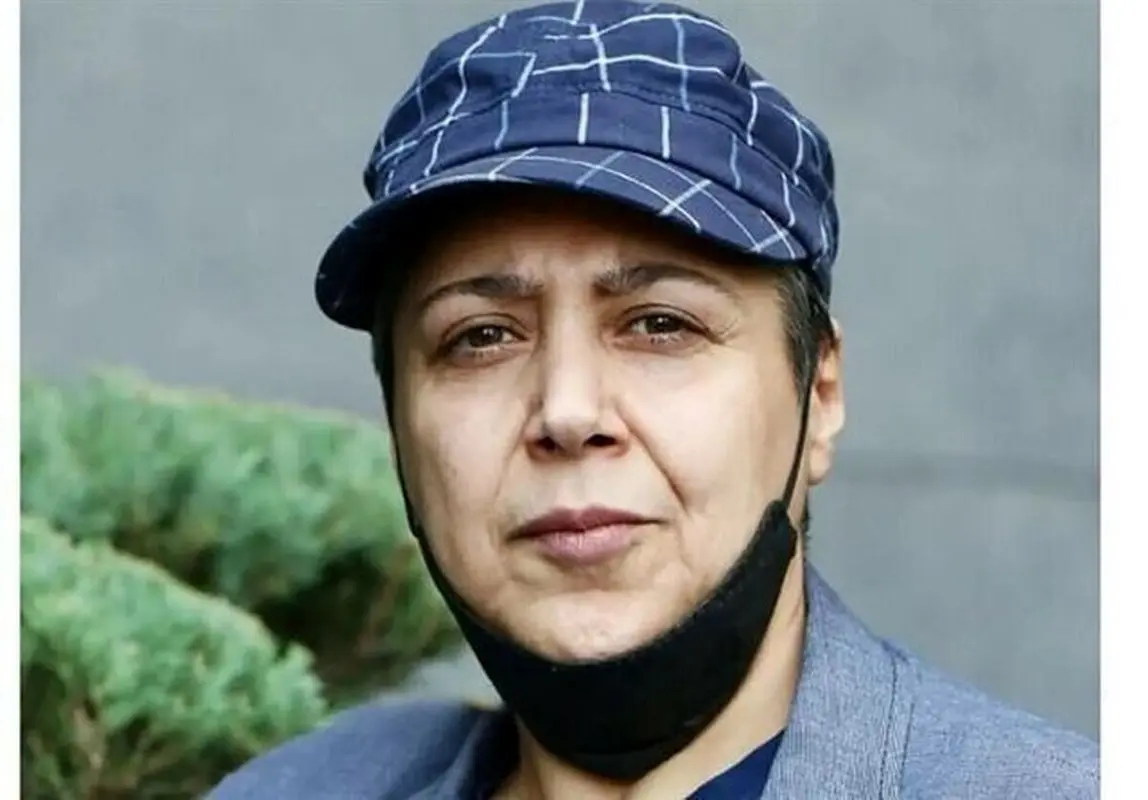 تیپ جدید مردانه “مازیار لرستانی” بعد عمل/ عکس