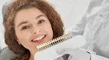 درمان لمینت دندان چند جلسه و چقدر زمان لازم دارد؟