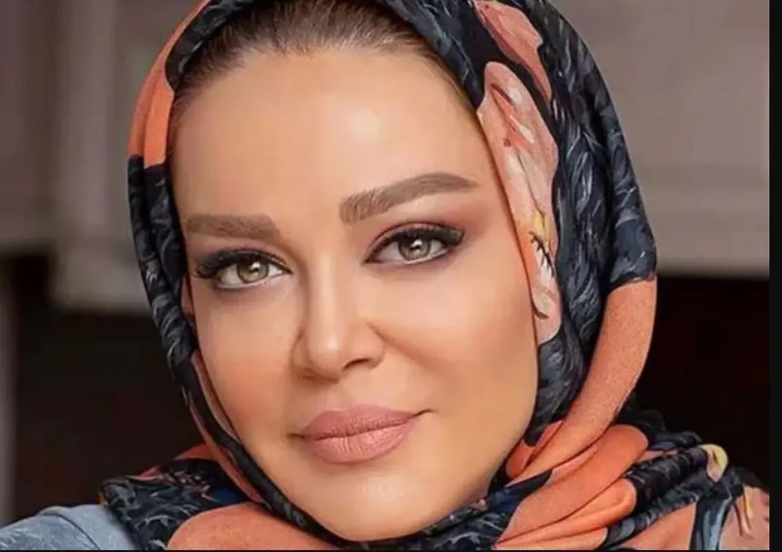 چهره باورنکردنی مادر بهاره رهنما پس از بیماری سخت! + عکس