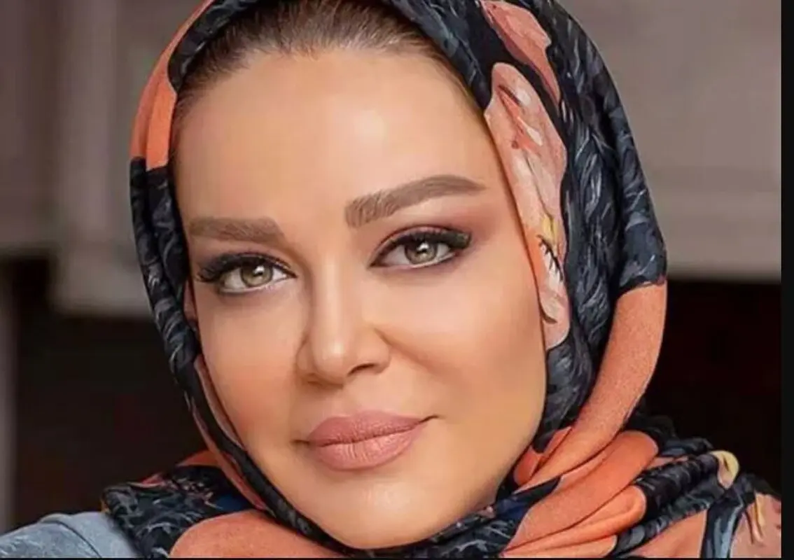 چهره باورنکردنی مادر بهاره رهنما پس از بیماری سخت! + عکس