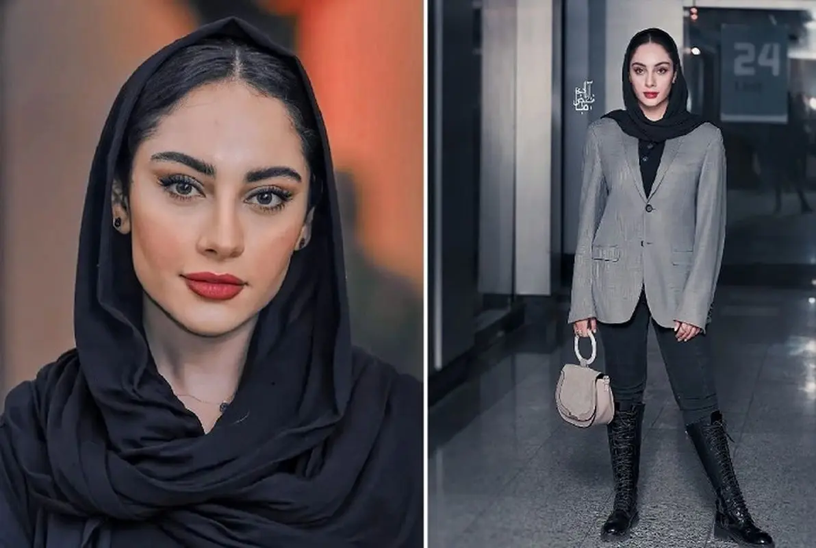 استوری اعتراضی ترلان پروانه با عکس سیاه و سفید + حال ترلان پروانه خوب نیست!