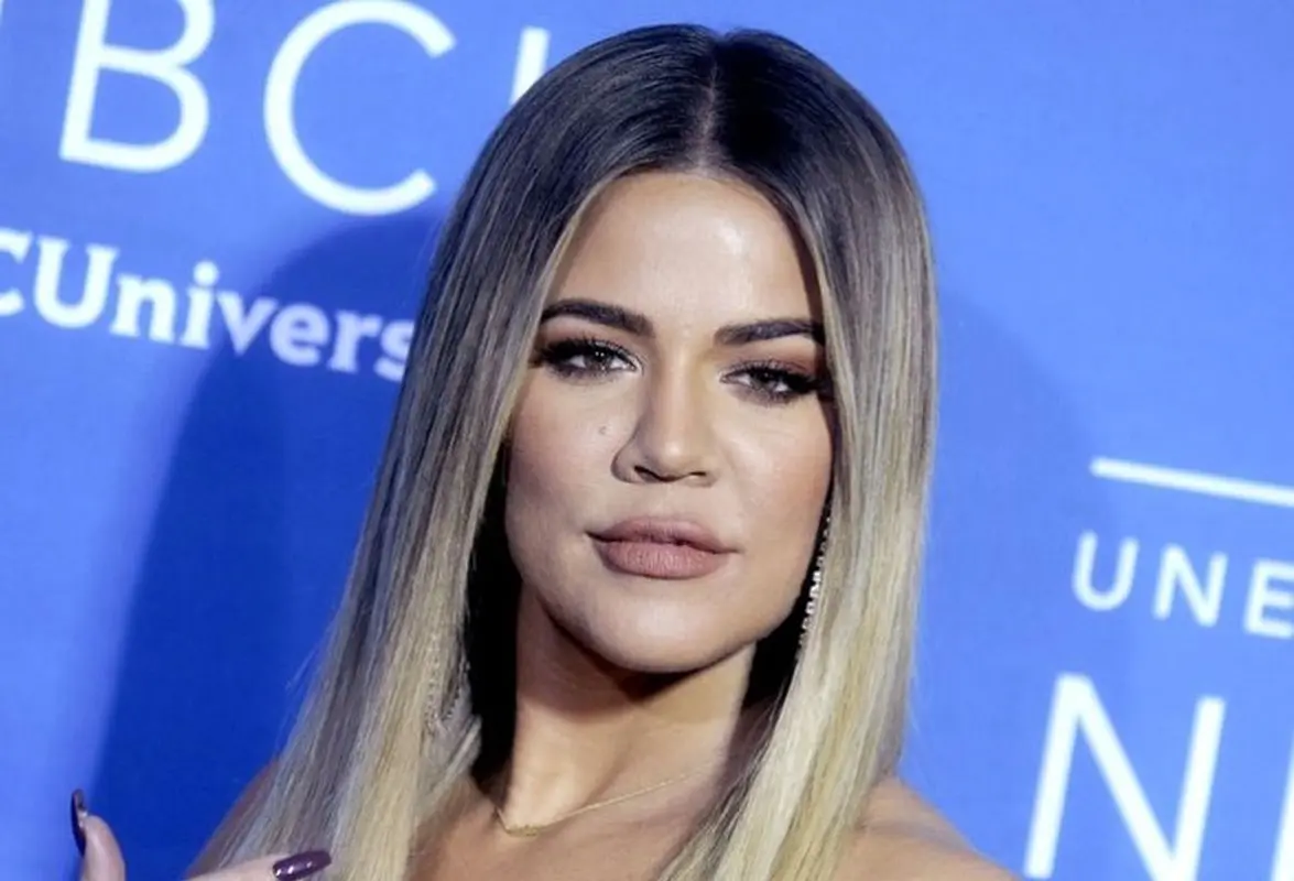 سنت شکنی کلویی کارداشیان با انتشار عکس بدون آرایش/ جراحت و زخم وحشتناک خانم ستاره بر روی صورتش! 