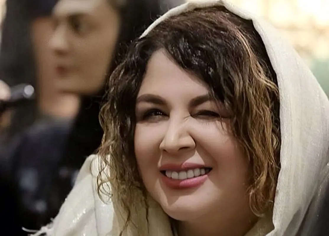 از چهره قبل عمل بینی خانم بازیگر تعجب می کنید/ شهره سلطانی قبل عمل زیبایی