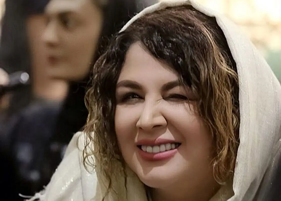 از چهره قبل عمل بینی خانم بازیگر تعجب می کنید/ شهره سلطانی قبل عمل زیبایی