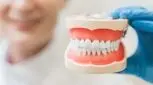 کاشت دندان بدون ایمپلنت، انواع، مزایا و معایب آن