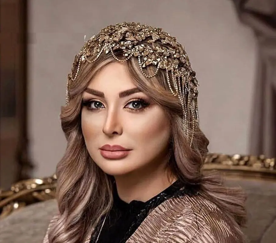 نیوشا ضیغمی قبل از معروفیت این شکلی بود/ عکس قدیمی خانم بازیگر رکورددار عمل های زیبایی