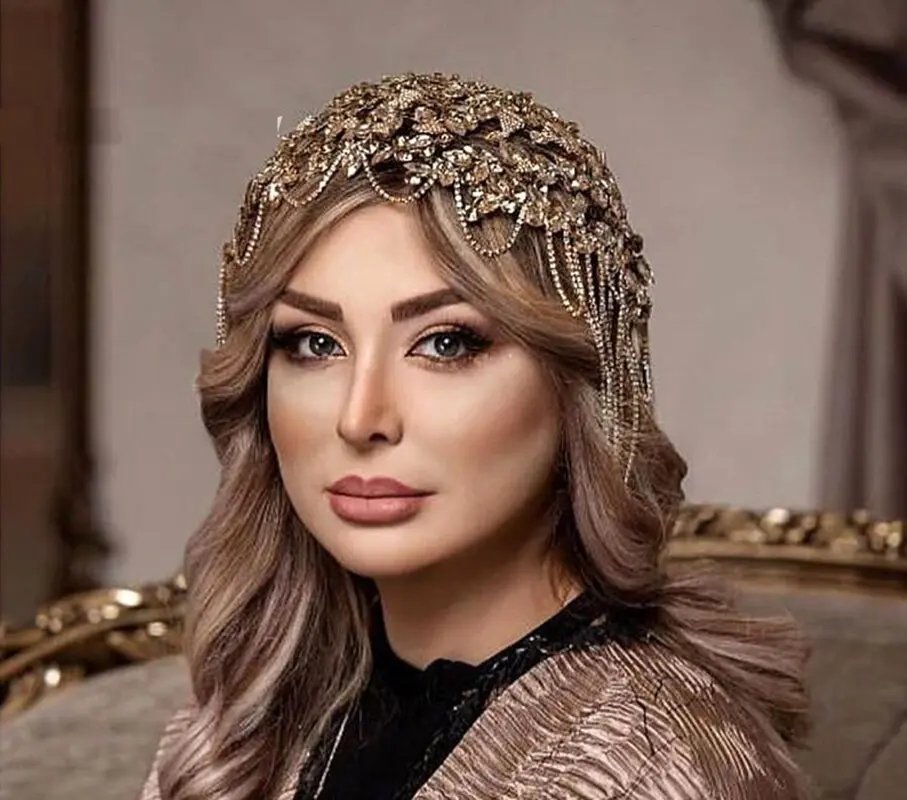 نیوشا ضیغمی قبل از معروفیت این شکلی بود/ عکس قدیمی خانم بازیگر رکورددار عمل های زیبایی