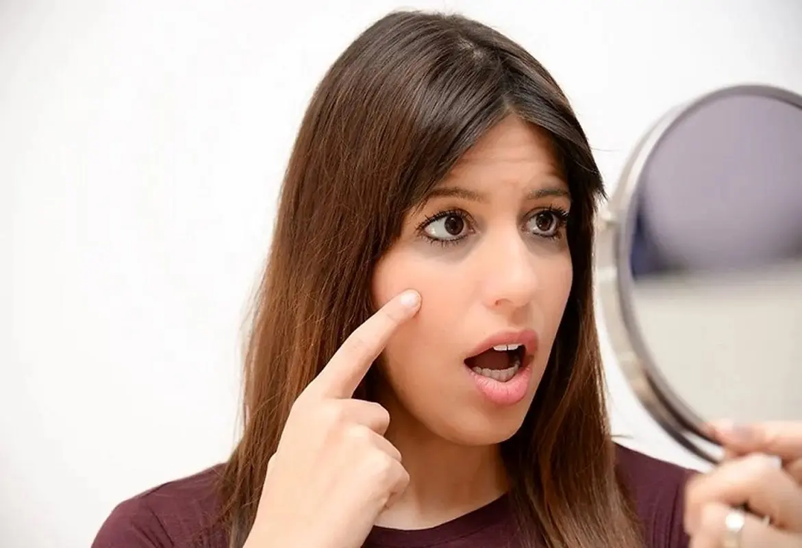 سیاهی زیر چشم در بارداری نشانه چیست؟ ۱۰ درمان خانگی موثر 