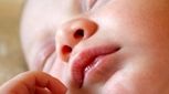 برفک دهان نوزاد چیست؟ تشخیص و درمان برفک دهان نوزاد 
