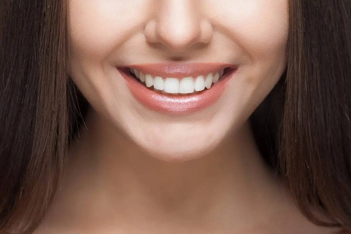 روش پزشکی و روش خانگی سفید کردن دندان