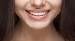 روش پزشکی و روش خانگی سفید کردن دندان