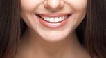 روش پزشکی و روش خانگی سفید کردن دندان