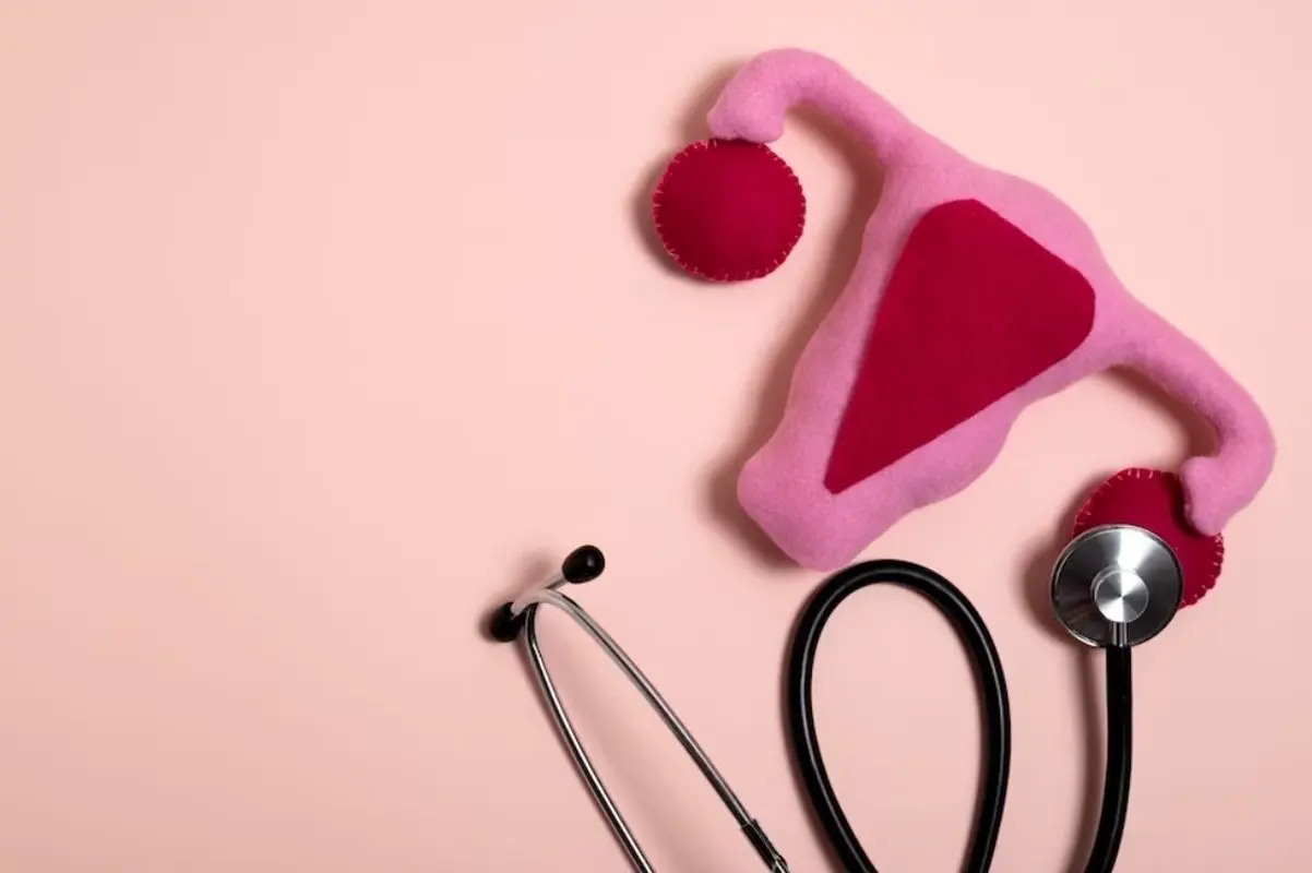 ۷ درمان گیاهی سندرم تحریک بیش از حد تخمدان