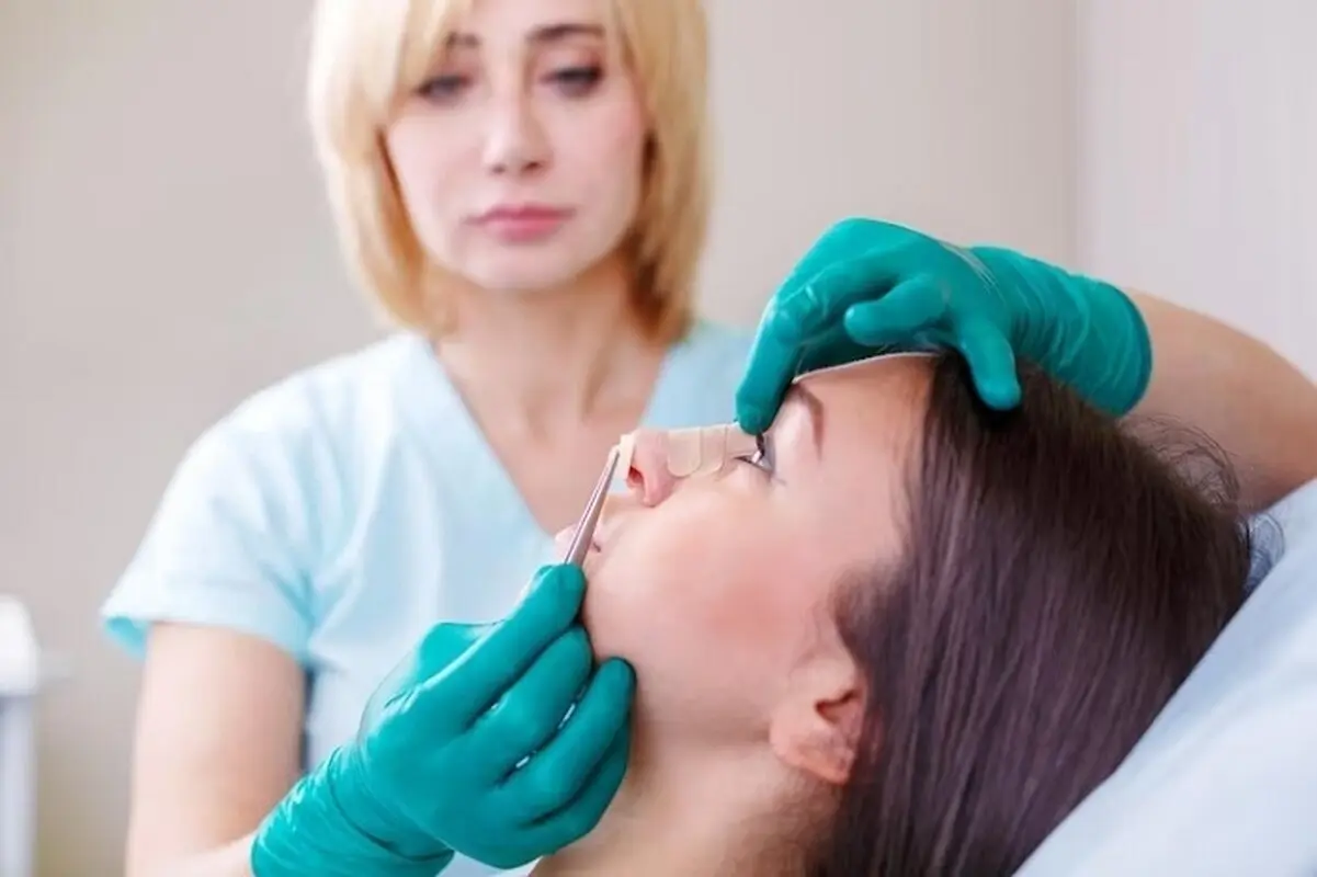 نحوه انتخاب پزشک برای عمل بینی: 7 نکته مهم