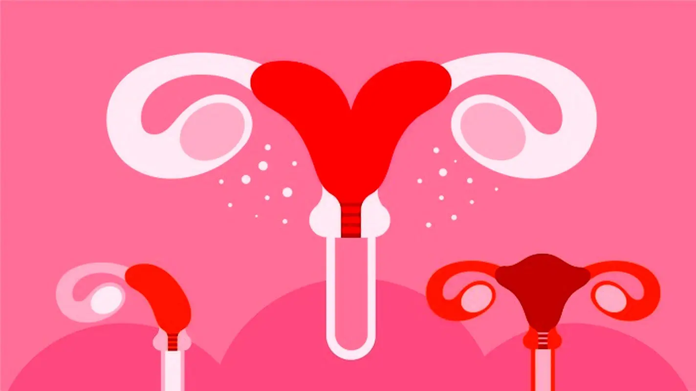 آیا رحم دوشاخ باعث نازایی می شود؟