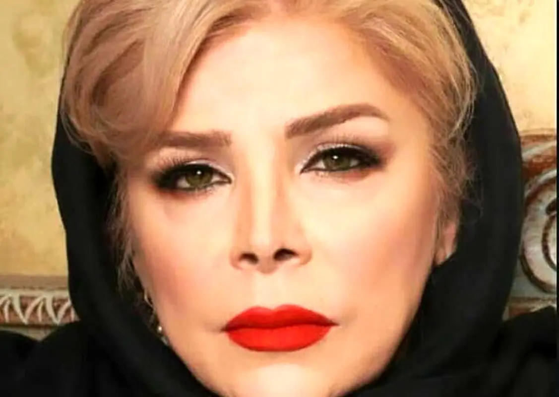 چهره پیر و شکسته خانم بازیگر همه را شوکه کرد!/چهره باورنکردنی شیوا خنیاگر + عکس