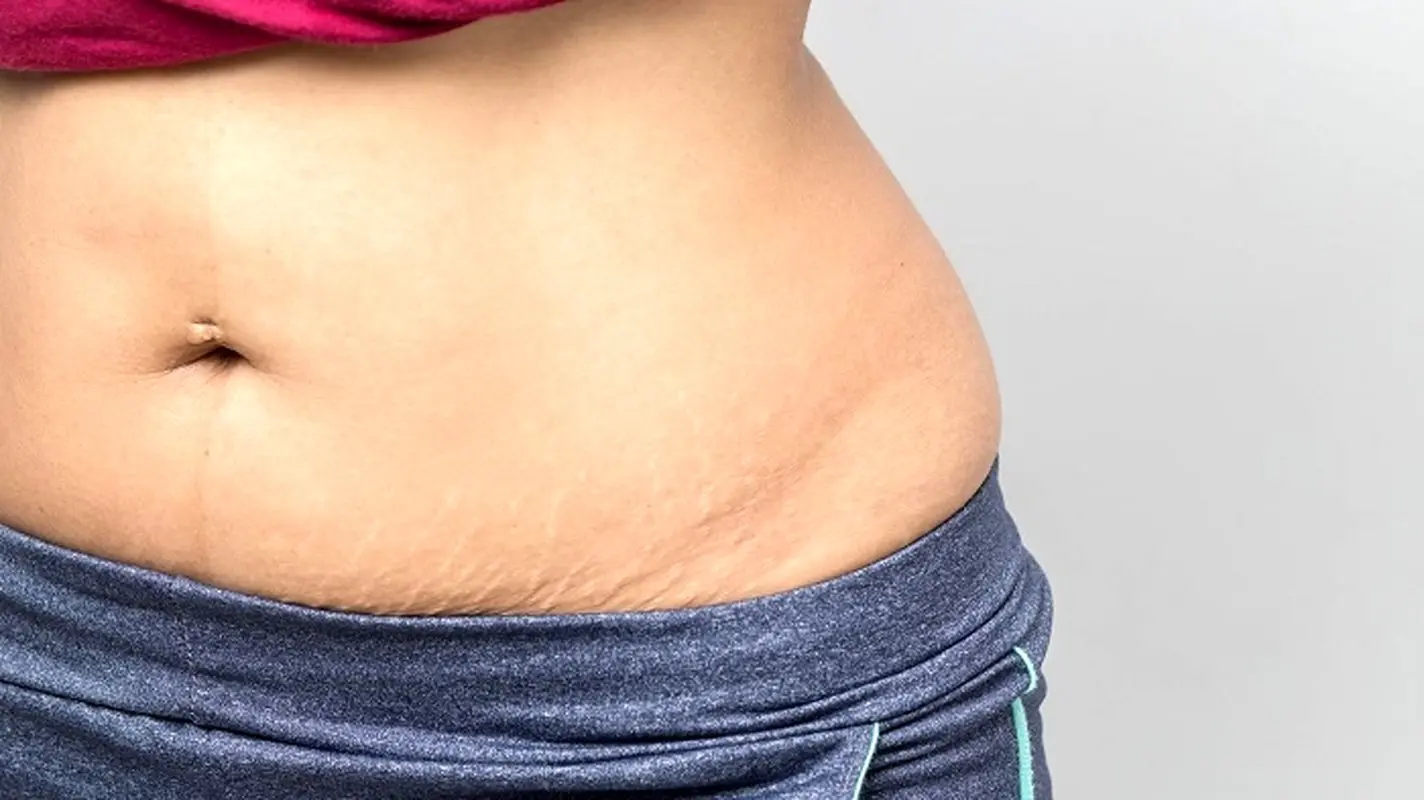 تغییرات بدن در ماه چهارم تا ششم بعد از زایمان چگونه است؟