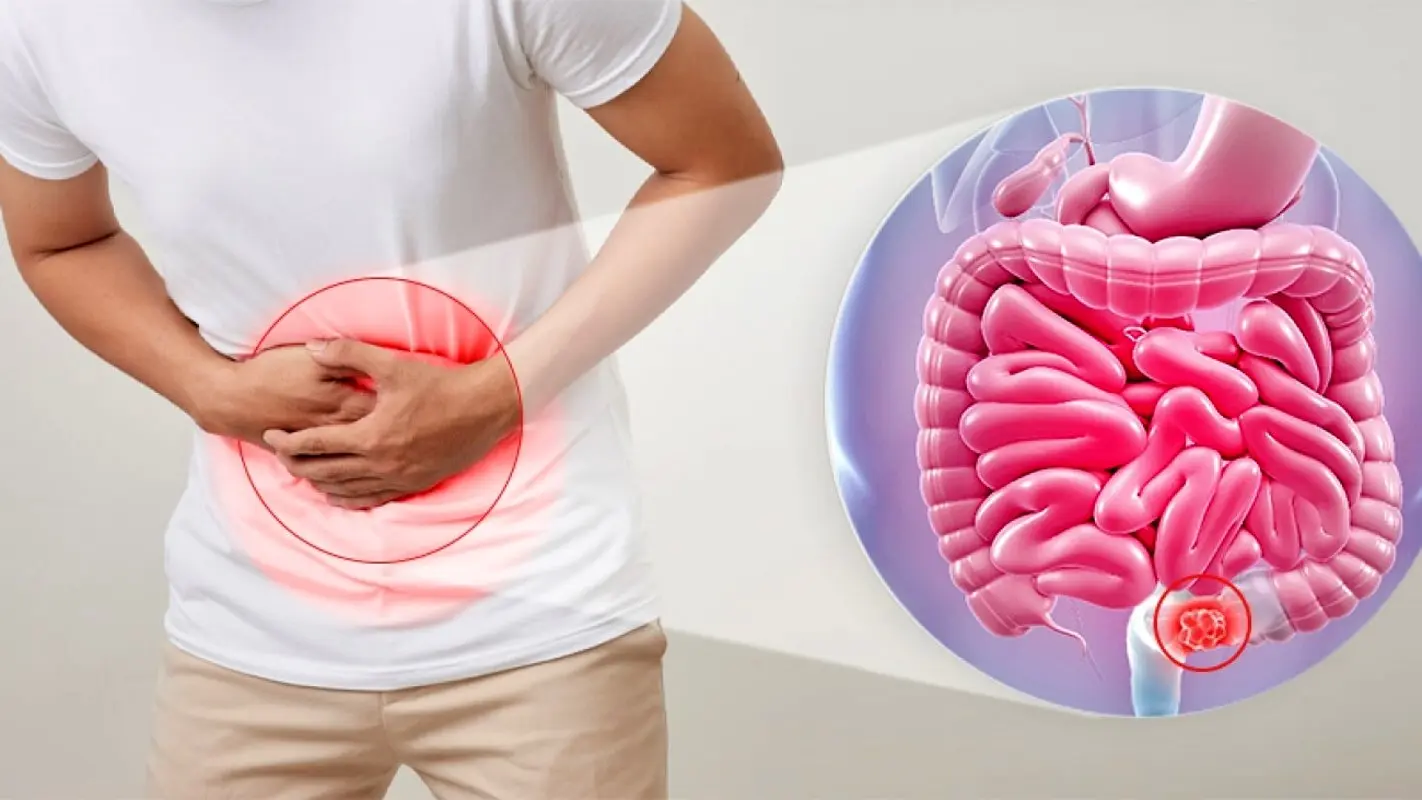 این خوراکی ها یبوست را بدتر می کنند