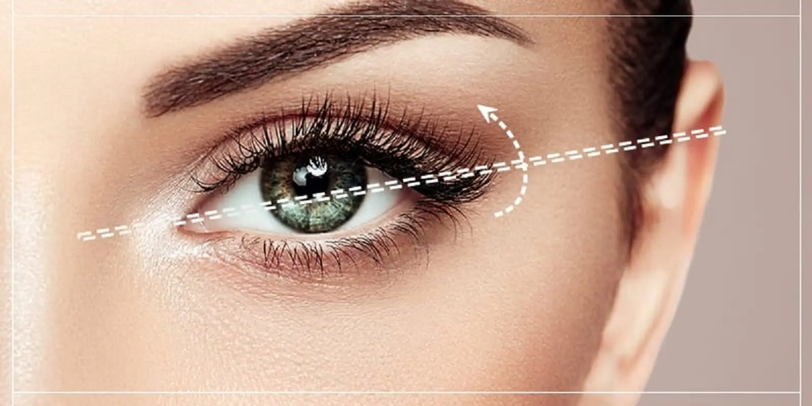 جوانسازی با جراحی زیبایی پلک، چه مزایا و معایبی دارد؟