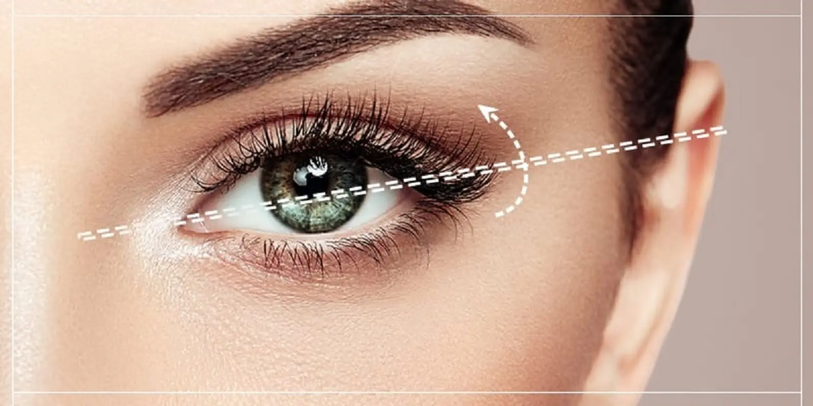 جوانسازی با جراحی زیبایی پلک، چه مزایا و معایبی دارد؟