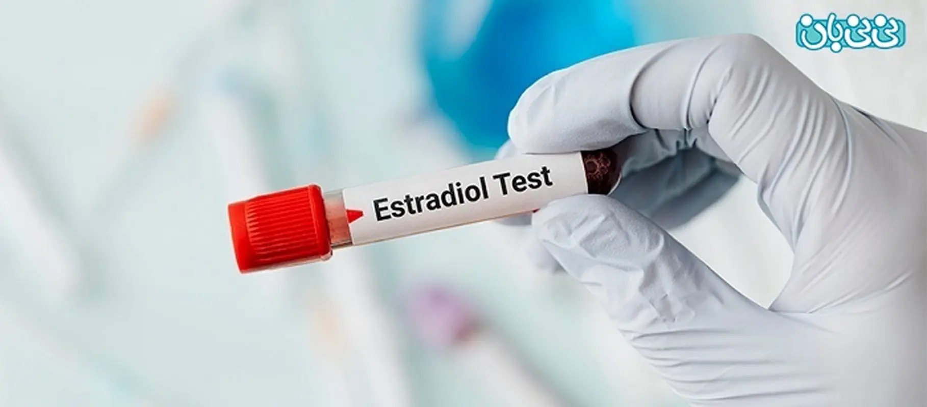 آزمایش استروژن، علت تجویز و تفسیر نتیجه