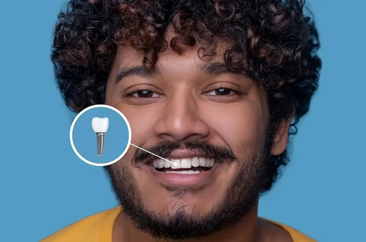 بهترین متخصص ایمپلنت در غرب تهران