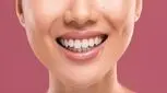 هزینه اصلاح طرح لبخند چقدر است؟
