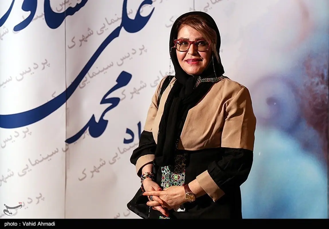 تغییر چهره عجیب بازیگر سریال خانه سبز!