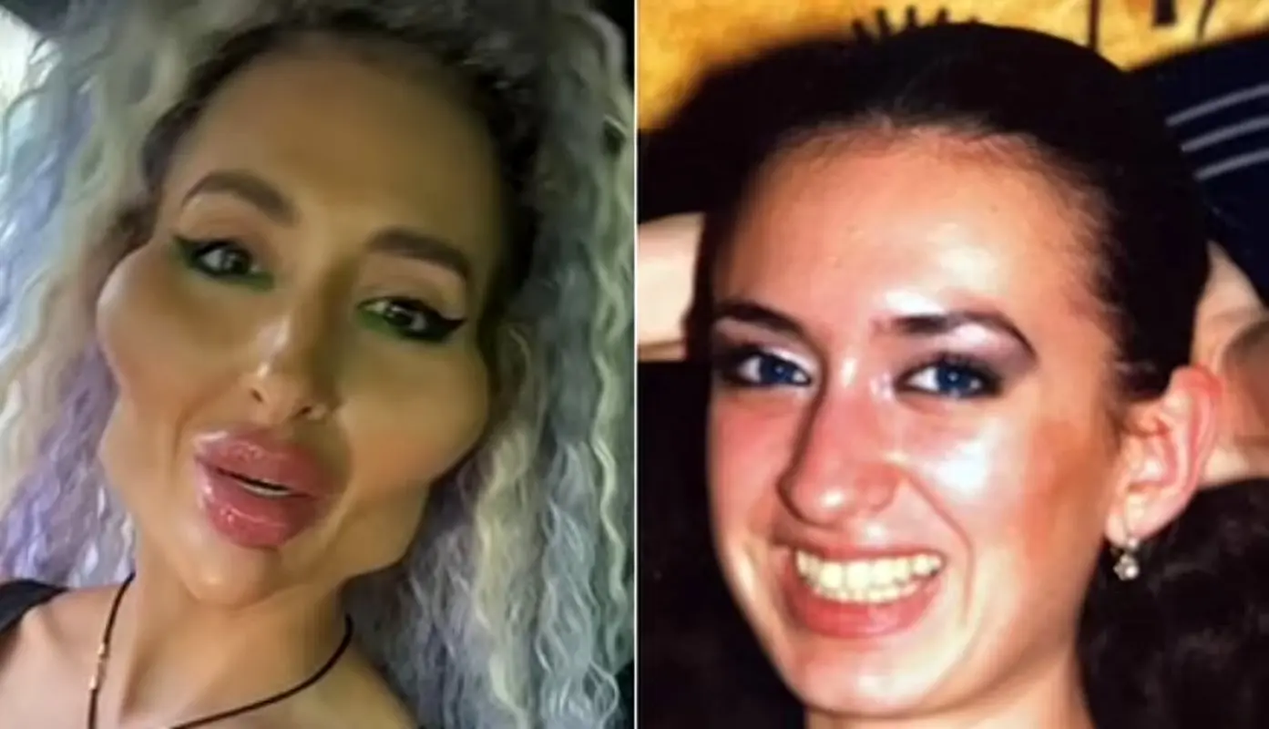 جراحی‌های زیبایی این زن تمامی ندارند، جراحی اخیر او طرفدارانش را نیز شوکه کرد