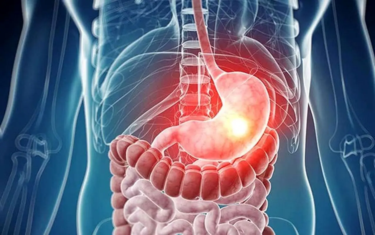 پاکسازی عجیب روده و کبد با این سبزی خوشمزه