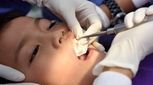 مراقبت های بعد از خارج کردن دندان شیری در کودکان