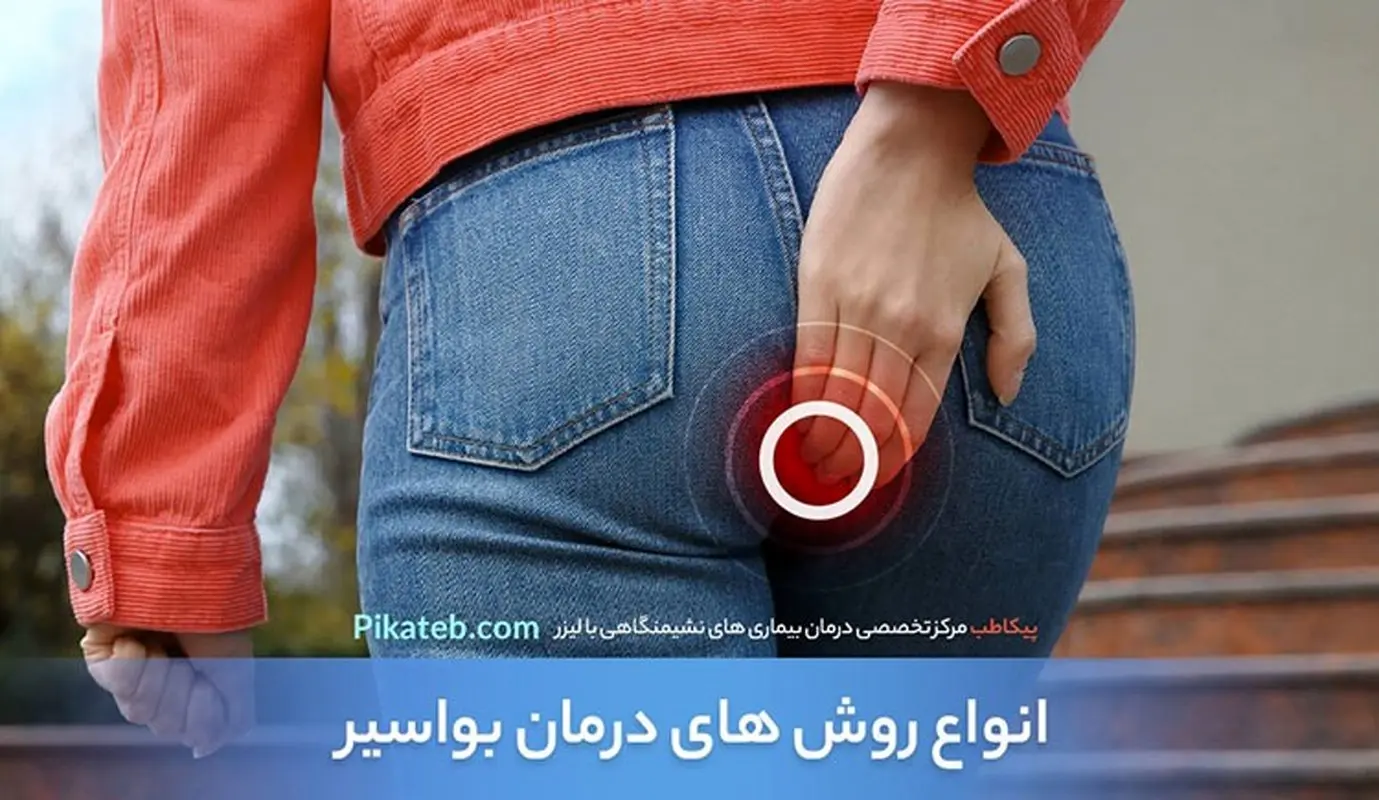 انواع روشهای درمان بواسیر یا هموروئید