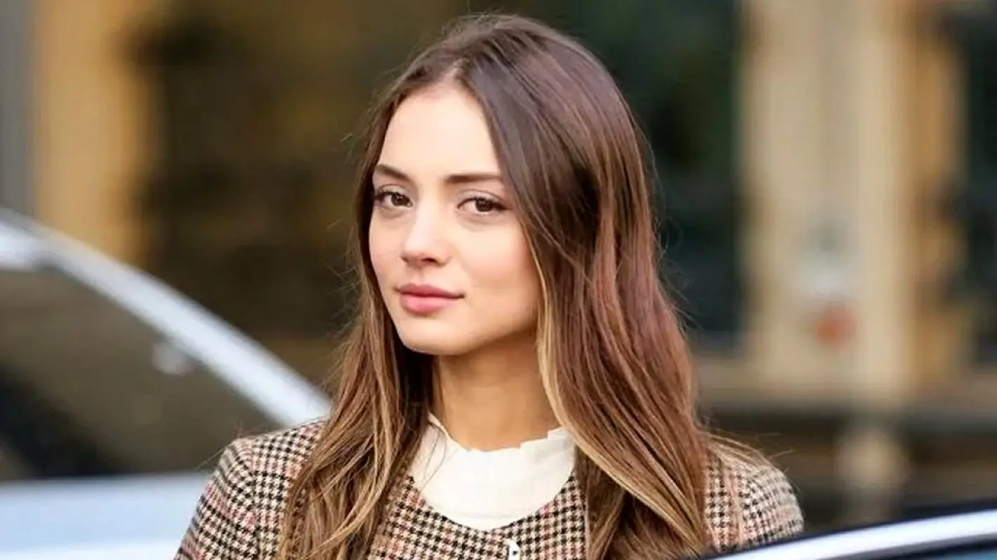 عکس عجیب خانم بازیگر قبل و بعد از عمل زیبایی