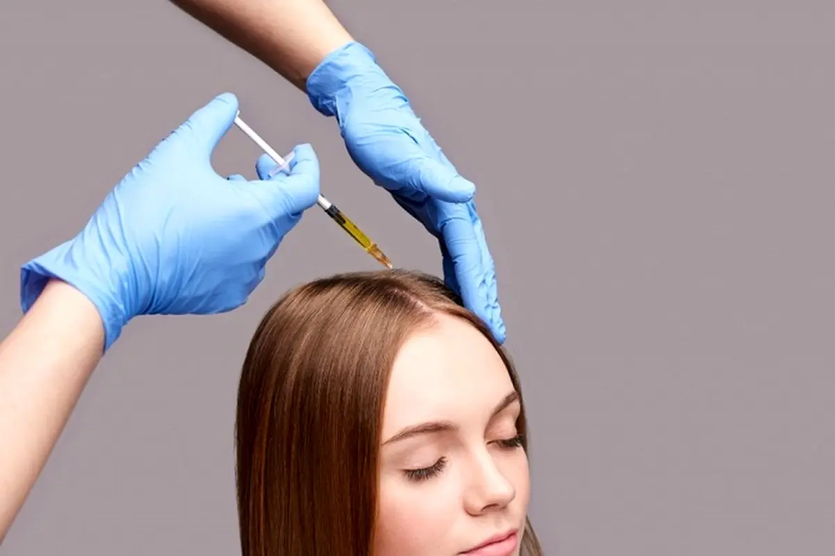 جلوگیری از ریزش مو با آمپول بیوتین