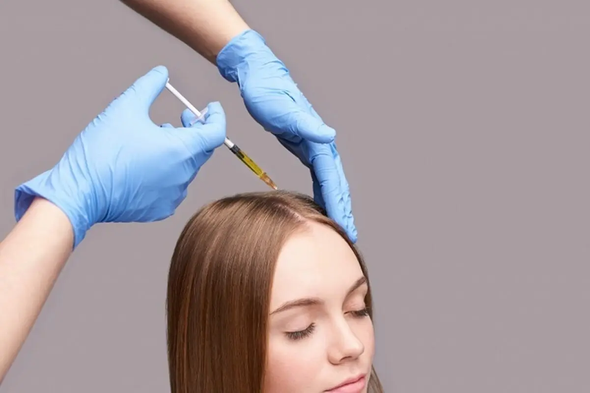 جلوگیری از ریزش مو با آمپول بیوتین