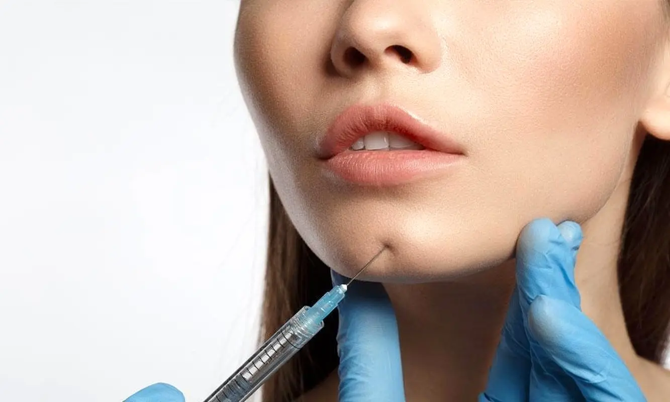تزریق ژل فیلر چانه چگونه انجام می شود؟ کاربرد، مزایا و عوارض