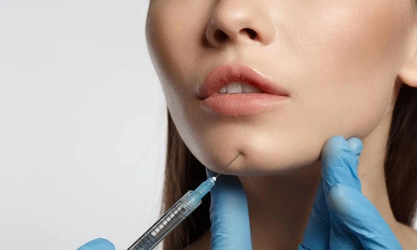 تزریق ژل فیلر چانه چگونه انجام می شود؟ کاربرد، مزایا و عوارض