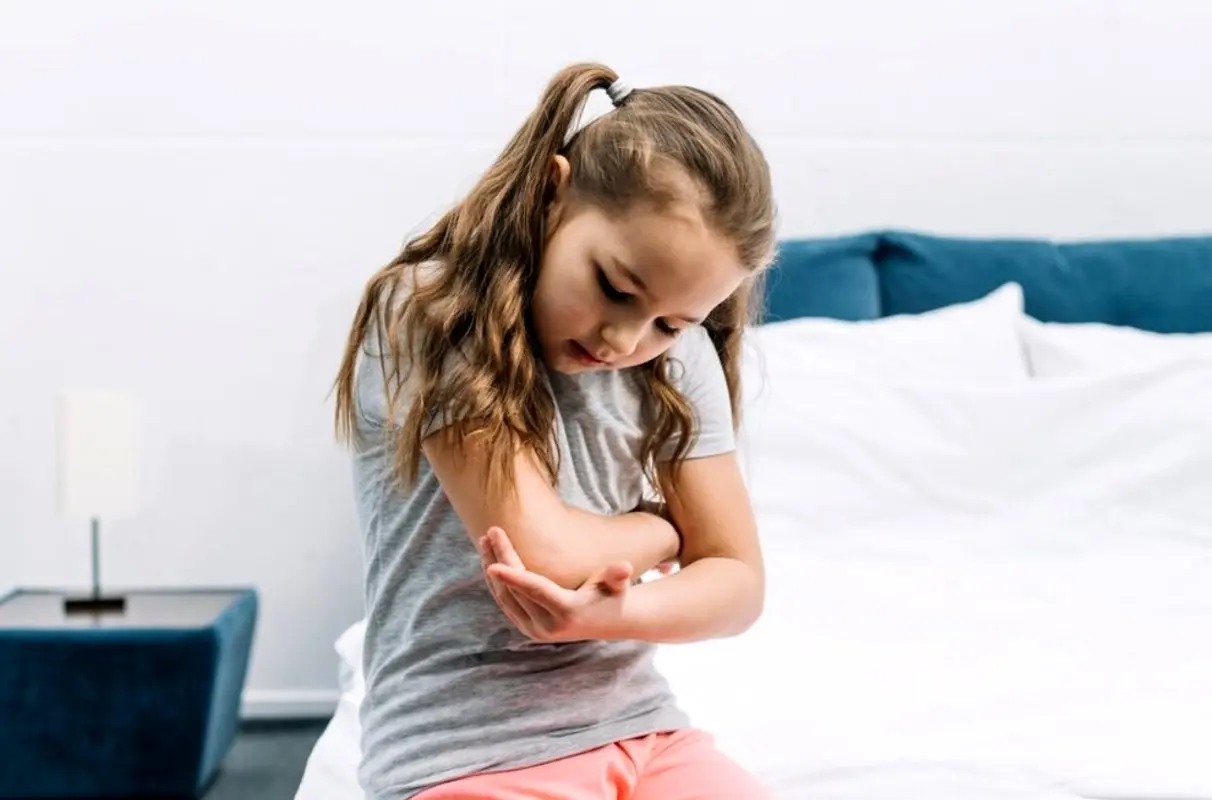 علائم، عوارض، کنترل و درمان پسوریازیس در کودکان