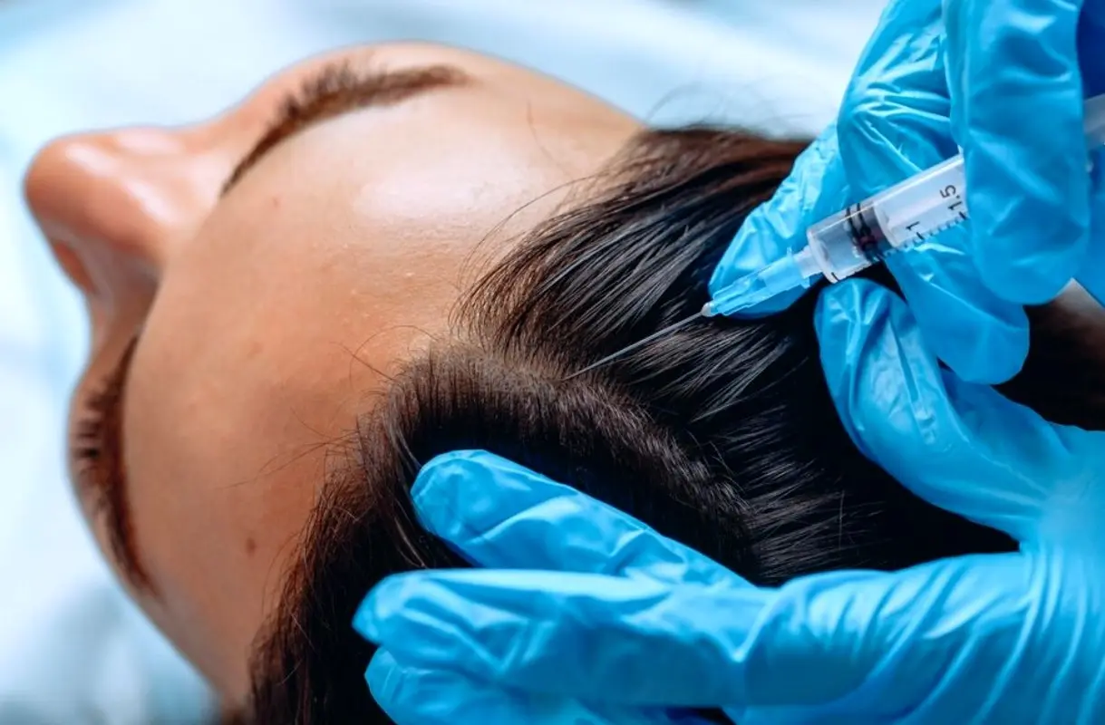 هزینه مزوتراپی مو در سال 1404 چقدر است؟