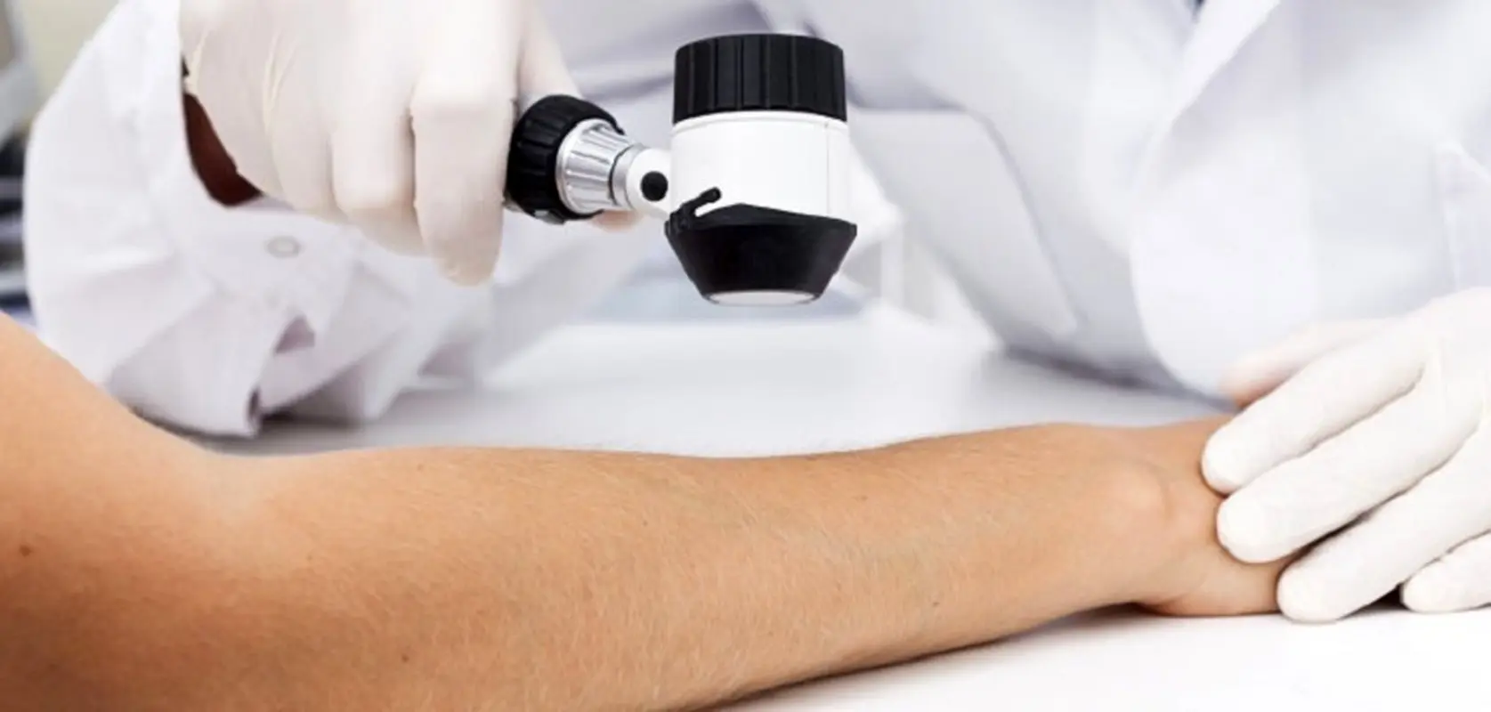 زگیل آبکی چیست؟ علایم و درمان این بیماری مقاربتی