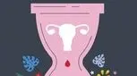 اندومتریوز در یائسگی