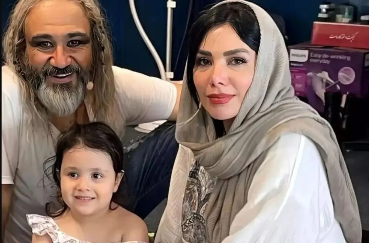 کار زیبایی همسر مهران غفوریان / خانم بلاگر فرم صورتش را تغییر داد! + عکس