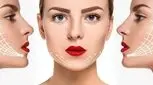 آشنایی با عوارض لیفت شقیقه با نخ؛ خطرناک ترین عوارض لیفت شقیقه با نخ