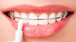 ارتودنسی ثابت و ارتودنسی متحرک: مقایسه دو روش درمانی برای اصلاح انحراف دندان‌ها