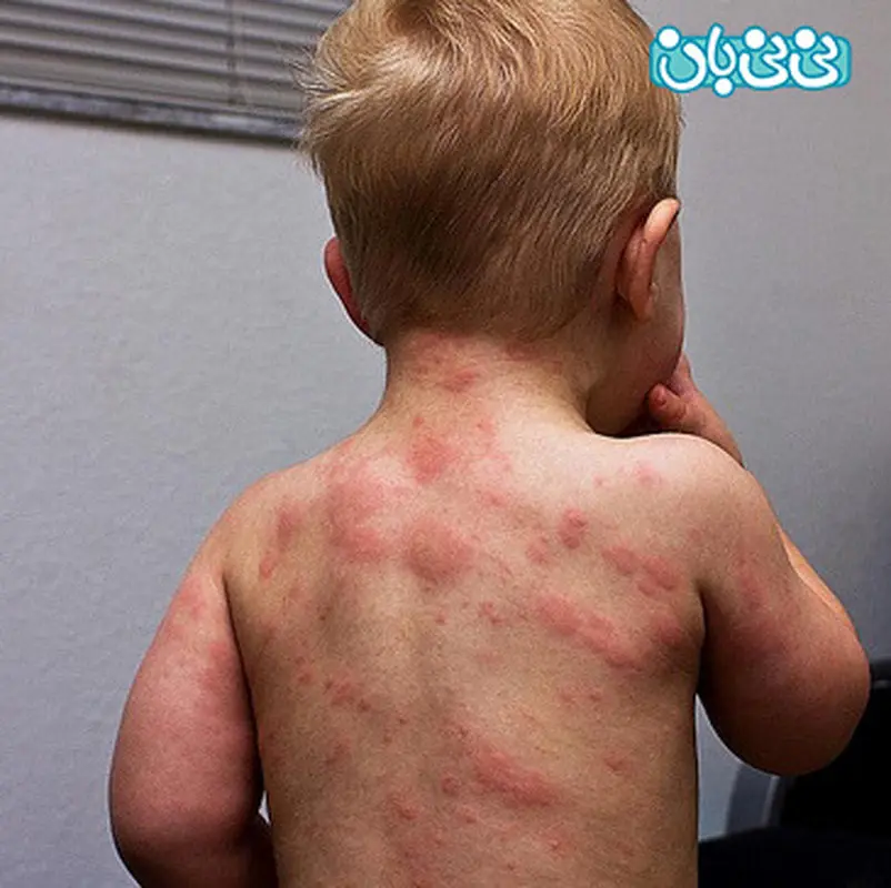 بیماری ششم نوزادان، چگونگی انتقال ‏آن