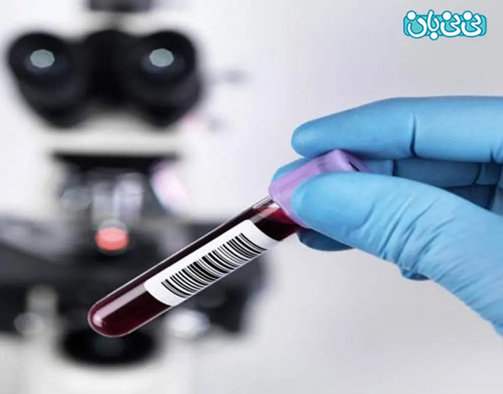 تشخیص جنسیت جنین، آزمایش خون نتیجه می دهد؟