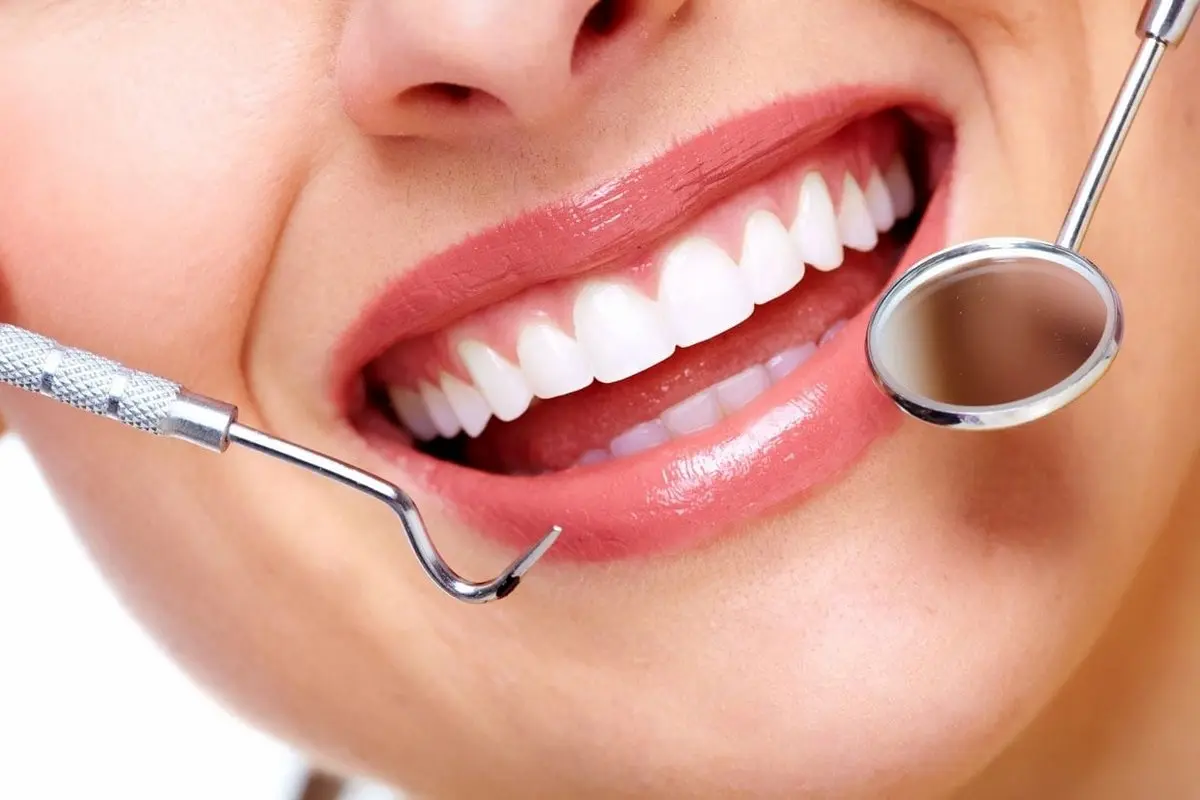 نکات مهم برای انتخاب دندانپزشک برای درمانهای زیبایی